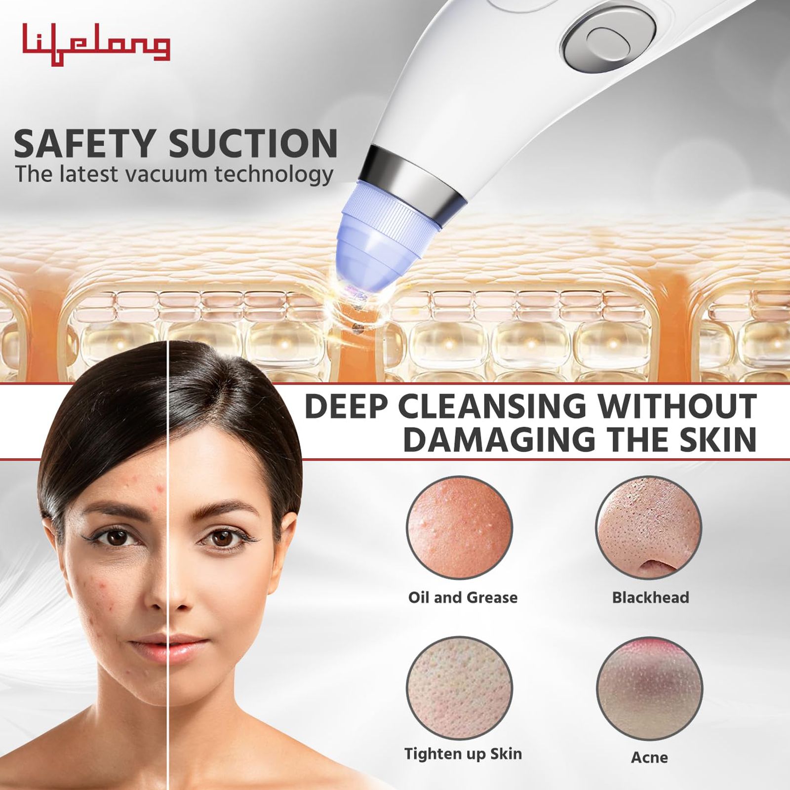 Lifelong LLPCW207 Pore Cleanser (Advanced Vacuum Technology, White)_5