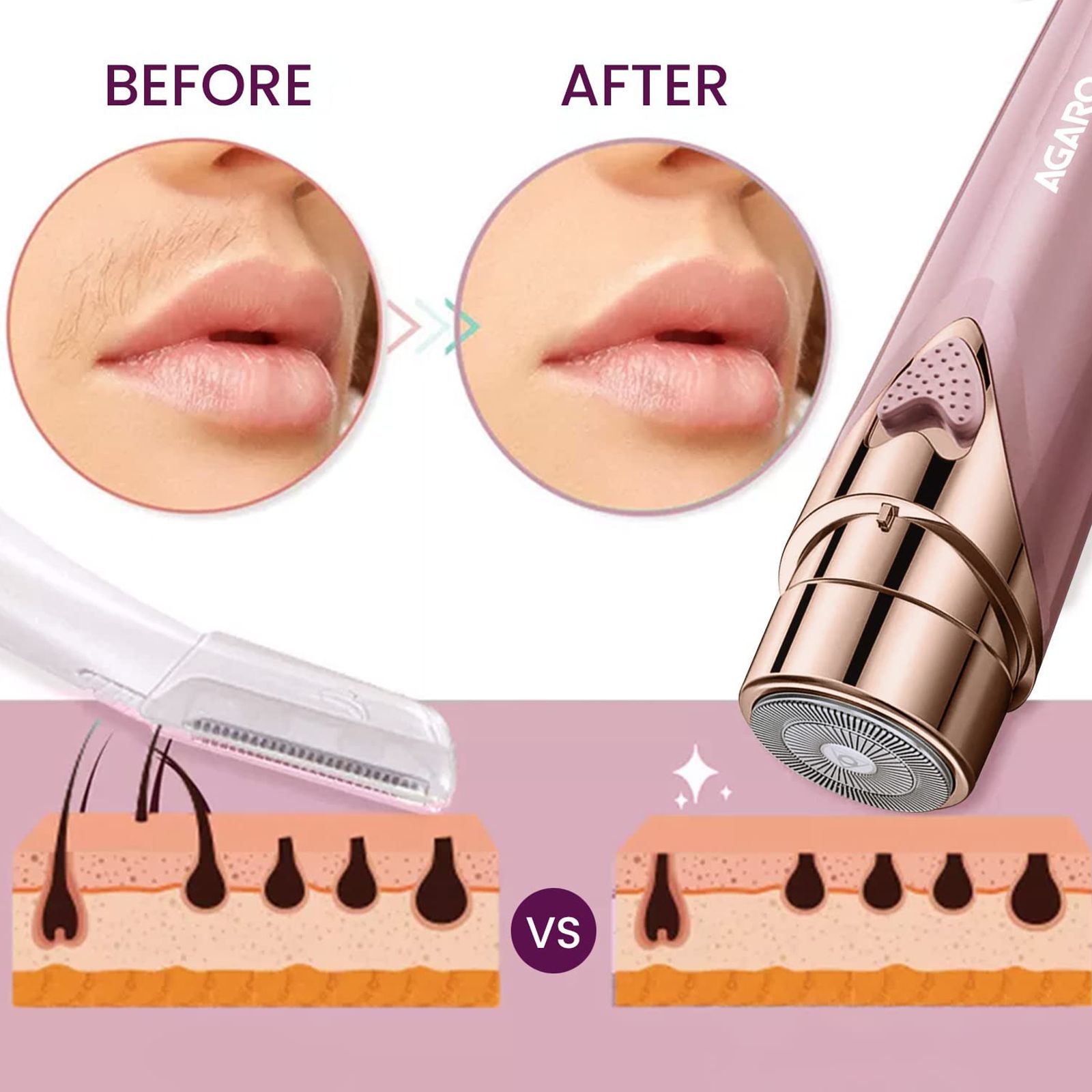 AGARO MHR100 Rechargeable Cordless Grooming Kit for Face for Women (Double Rotating Blades, Rose Gold)_4